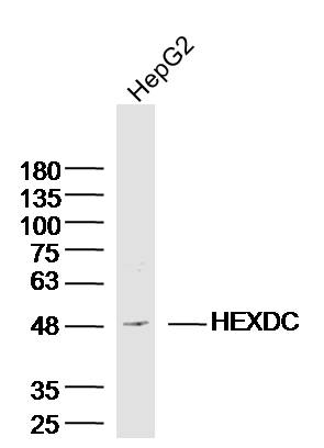 HepG2 lysates probed with HEXDC Polyclonal Antibody, Unconjugated (bs-8418R) at 1:300 dilution and 4˚C overnight incubation. Followed by conjugated secondary antibody incubation at 1:10000 for 60 min at 37˚C.