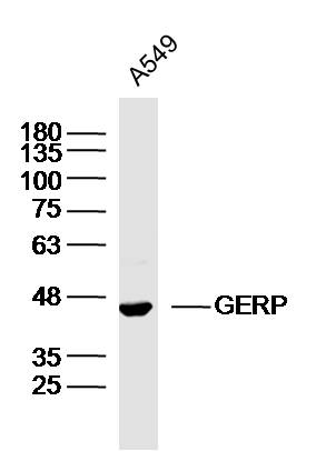 A549 lysates probed with GERP Polyclonal Antibody, Unconjugated (bs-8436R) at 1:300 dilution and 4˚C overnight incubation. Followed by conjugated secondary antibody incubation at 1:10000 for 60 min at 37˚C.