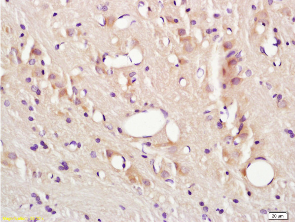 Formalin-fixed and paraffin embedded rat brain tissue labeled with Anti-CD54/ICAM-1 Polyclonal Antibody (bs-0608R), Unconjugated at 1:200, followed by conjugation to the secondary antibody and DAB staining