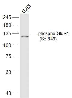 U251 lysates probed with phospho-GluR1 (Ser849) Polyclonal Antibody, Unconjugated (bs-8446R) at 1:500 dilution and 4˚C overnight incubation. Followed by conjugated secondary antibody incubation at 1:10000 for 60 min at 37˚C. U251 lysates probed with phospho-GluR1 (Ser849) Polyclonal Antibody, Unconjugated (bs-8446R) at 1:500 dilution and 4˚C overnight incubation. Followed by conjugated secondary antibody incubation at 1:10000 for 60 min at 37˚C.