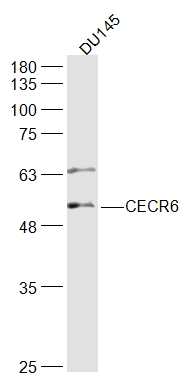 DU145 lysates probed with CECR6 Polyclonal Antibody, Unconjugated (bs-9006R) at 1:500 dilution and 4˚C overnight incubation. Followed by conjugated secondary antibody incubation at 1:10000 for 60 min at 37˚C.