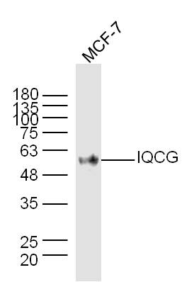MCF-7 lysates probed with IQCG Polyclonal Antibody, Unconjugated (bs-9022R) at 1:300 dilution and 4˚C overnight incubation. Followed by conjugated secondary antibody incubation at 1:10000 for 60 min at 37˚C.