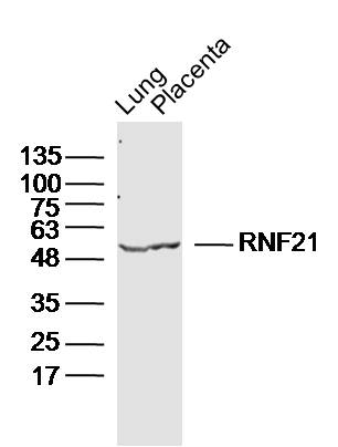 Lane 1: Mouse Lung lysates; Lane 2: Mouse Placenta lysates probed with RNF21 Polyclonal Antibody, Unconjugated (bs-9244R) at 1:300 dilution and 4˚C overnight incubation. Followed by conjugated secondary antibody incubation at 1:10000 for 60 min at 37˚C.
