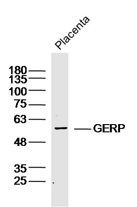 Mouse placenta lysates probed with GERP Polyclonal Antibody, Unconjugated (bs-9432R) at 1:300 dilution and 4˚C overnight incubation. Followed by conjugated secondary antibody incubation at 1:10000 for 60 min at 37˚C. Mouse placenta lysates probed with GERP Polyclonal Antibody, Unconjugated (bs-9432R) at 1:300 dilution and 4˚C overnight incubation. Followed by conjugated secondary antibody incubation at 1:10000 for 60 min at 37˚C.