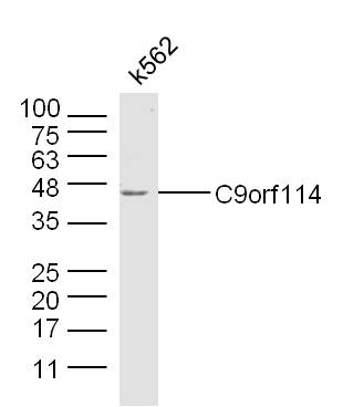 K562 lysates probed with C9orf114 Polyclonal Antibody, Unconjugated (bs-9494R) at 1:300 dilution and 4˚C overnight incubation. Followed by conjugated secondary antibody incubation at 1:10000 for 60 min at 37˚C.
