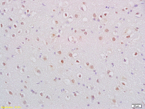 Formalin-fixed and paraffin embedded rat brain labeled with Anti-BDNF Polyclonal Antibody, Unconjugated (bs-4989R) at 1:200 followed by conjugation to the secondary antibody and DAB staining.