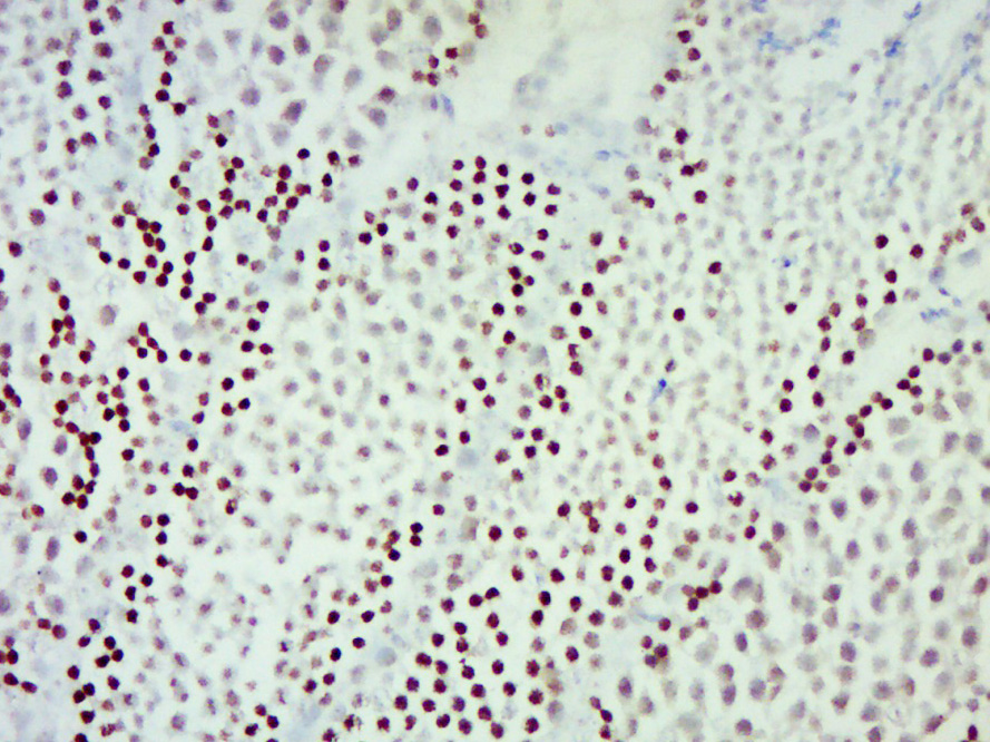 Paraformaldehyde-fixed, paraffin embedded mouse testis; Antigen retrieval by boiling in sodium citrate buffer (pH6.0) for 15min; Block endogenous peroxidase by 3% hydrogen peroxide for 20 minutes; Blocking buffer (normal goat serum) at 37°C for 30min; Antibody incubation with RAD54B Polyclonal Antibody, Unconjugated (bs-5940R) at 1:400 overnight at 4°C, DAB staining.