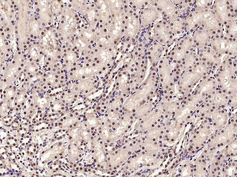 Paraformaldehyde-fixed, paraffin embedded Rat kidney; Antigen retrieval by boiling in sodium citrate buffer (pH6.0) for 15min; Block endogenous peroxidase by 3% hydrogen peroxide for 20 minutes; Blocking buffer (normal goat serum) at 37°C for 30min; Antibody incubation with PHAP Polyclonal Antibody, Unconjugated (bs-6083R) at 1:400 overnight at 4°C, DAB staining.