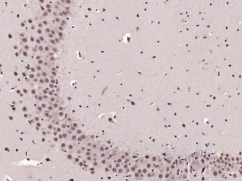 Paraformaldehyde-fixed, paraffin embedded mouse brain; Antigen retrieval by boiling in sodium citrate buffer (pH6.0) for 15min; Block endogenous peroxidase by 3% hydrogen peroxide for 20 minutes; Blocking buffer (normal goat serum) at 37°C for 30min; Antibody incubation with PHAP Polyclonal Antibody, Unconjugated (bs-6083R) at 1:400 overnight at 4°C, DAB staining.