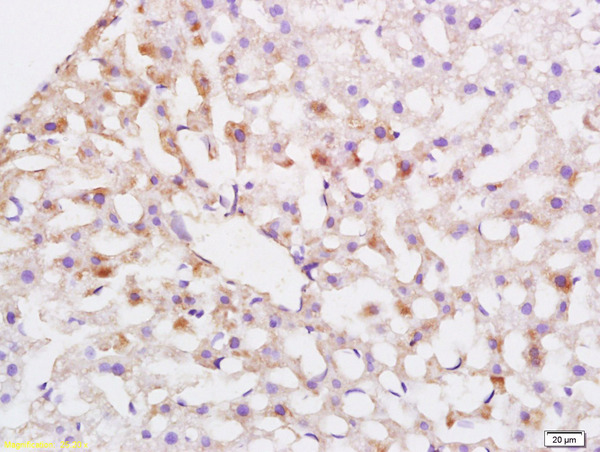 Formalin-fixed and paraffin embedded rat liver labeled with Anti-ABCG5 Polyclonal Antibody, Unconjugated (bs-5013R) at 1:200 followed by conjugation to the secondary antibody and DAB staining.