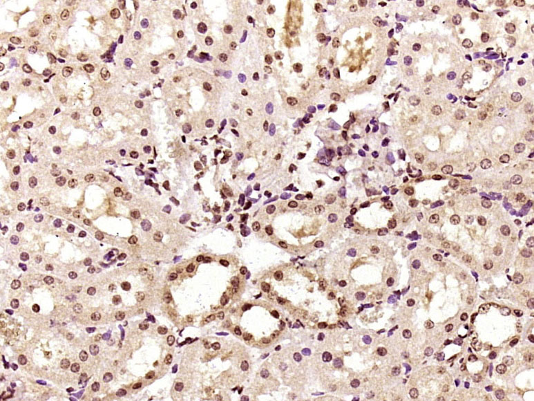 Paraformaldehyde-fixed, paraffin embedded Rat kidney; Antigen retrieval by boiling in sodium citrate buffer (pH6.0) for 15min; Block endogenous peroxidase by 3% hydrogen peroxide for 20 minutes; Blocking buffer (normal goat serum) at 37°C for 30min; Antibody incubation with PP2A alpha / beta(Tyr307) Polyclonal Antibody, Unconjugated (bs-6419R) at 1:400 overnight at 4°C, DAB staining.