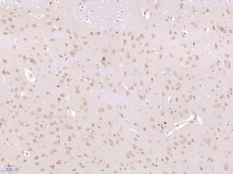 Paraformaldehyde-fixed, paraffin embedded Rat brain; Antigen retrieval by boiling in sodium citrate buffer (pH6.0) for 15min; Block endogenous peroxidase by 3% hydrogen peroxide for 20 minutes; Blocking buffer (normal goat serum) at 37°C for 30min; Antibody incubation with FRS2 Polyclonal Antibody, Unconjugated (bs-6913R) at 1:400 overnight at 4°C, DAB staining.