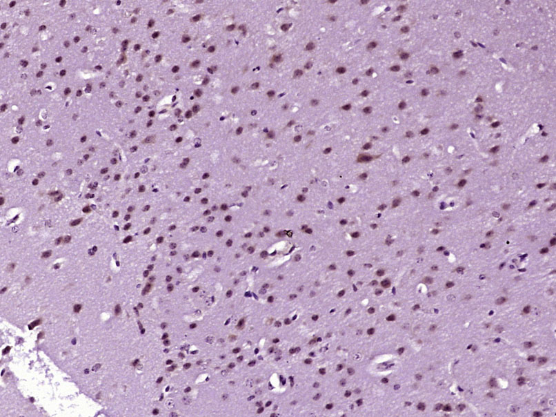 Paraformaldehyde-fixed, paraffin embedded Mouse brain; Antigen retrieval by boiling in sodium citrate buffer (pH6.0) for 15min; Block endogenous peroxidase by 3% hydrogen peroxide for 20 minutes; Blocking buffer (normal goat serum) at 37°C for 30min; Antibody incubation with DFFB Polyclonal Antibody, Unconjugated (bs-7648R) at 1:400 overnight at 4°C, DAB staining.