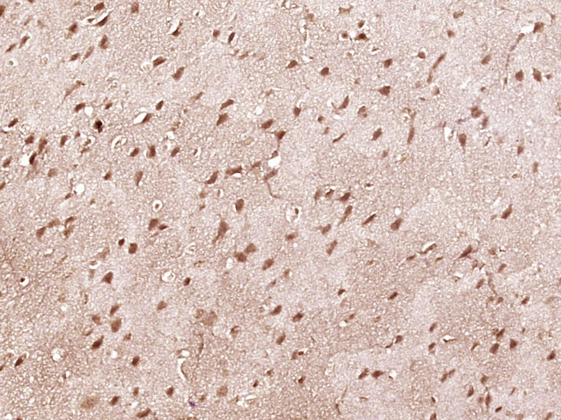 Paraformaldehyde-fixed, paraffin embedded Mouse brain; Antigen retrieval by boiling in sodium citrate buffer (pH6.0) for 15min; Block endogenous peroxidase by 3% hydrogen peroxide for 20 minutes; Blocking buffer (normal goat serum) at 37°C for 30min; Antibody incubation with STAT1 p84+p91 Polyclonal Antibody, Unconjugated (bs-9584R) at 1:400 overnight at 4°C, DAB staining.