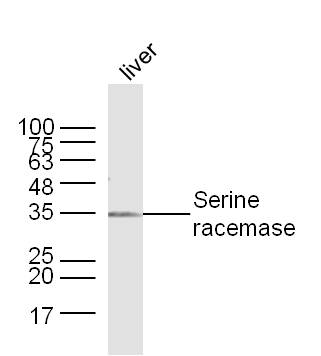 Mouse Liver lysates probed with Serine racemase Polyclonal Antibody, Unconjugated (bs-10474R) at 1:300 dilution and 4˚C overnight incubation. Followed by conjugated secondary antibody incubation at 1:10000 for 60 min at 37˚C. Mouse Liver lysates probed with Serine racemase Polyclonal Antibody, Unconjugated (bs-10474R) at 1:300 dilution and 4˚C overnight incubation. Followed by conjugated secondary antibody incubation at 1:10000 for 60 min at 37˚C.