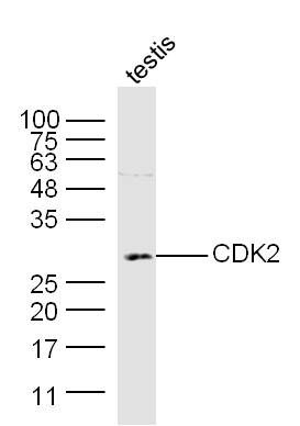 Mouse testis lysates probed with CDK2 Polyclonal Antibody, Unconjugated (bs-10726R) at 1:300 dilution and 4˚C overnight incubation. Followed by conjugated secondary antibody incubation at 1:10000 for 60 min at 37˚C.