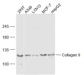 Lane 1: 293T lysates; Lane 2: A549 lysates; Lane 3: LOVO lysates; Lane 4: MCF-7 lysates;Lane 5: HepG2 lysates probed with COL2A1 Polyclonal Antibody, Unconjugated (bs-10589R) at 1:300 dilution and 4˚C overnight incubation. Followed by conjugated secondary antibody incubation at 1:10000 for 60 min at 37˚C. Lane 1: 293T lysates; Lane 2: A549 lysates; Lane 3: LOVO lysates; Lane 4: MCF-7 lysates;Lane 5: HepG2 lysates probed with COL2A1 Polyclonal Antibody, Unconjugated (bs-10589R) at 1:300 dilution and 4˚C overnight incubation. Followed by conjugated secondary antibody incubation at 1:10000 for 60 min at 37˚C.