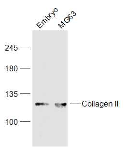 Lane 1: Mouse Embryo lysates; Lane 2: MG63 lysates probed with COL2A1 Polyclonal Antibody, Unconjugated (bs-10589R) at 1:300 dilution and 4˚C overnight incubation. Followed by conjugated secondary antibody incubation at 1:10000 for 60 min at 37˚C.