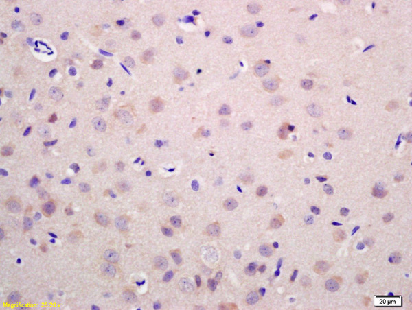 Formalin-fixed and paraffin embedded rat brain labeled with Anti-RAB21 Polyclonal Antibody, Unconjugated (bs-5830R) at 1:200 followed by conjugation to the secondary antibody and DAB staining.