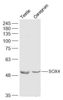 Lane 1: Mouse Testis lysates; Lane 2: Mouse Cerebrum lysates probed with SOX4 Polyclonal Antibody, Unconjugated (bs-11208R) at 1:500 dilution and 4˚C overnight incubation. Followed by conjugated secondary antibody incubation at 1:10000 for 60 min at 37˚C.