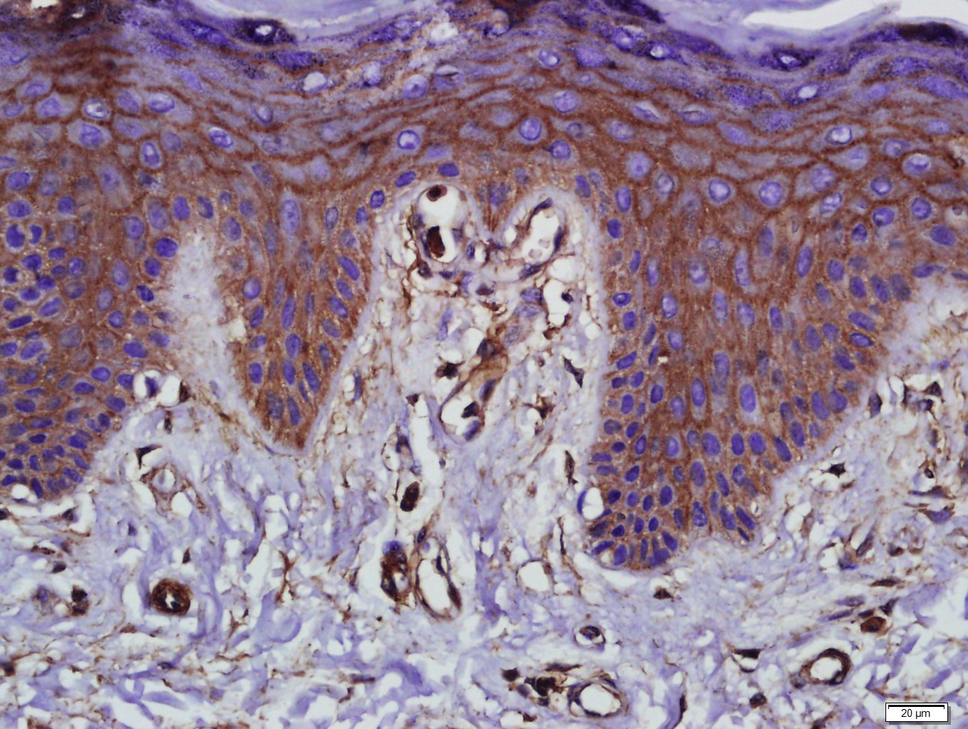 Paraformaldehyde-fixed, paraffin embedded human skin; Antigen retrieval by boiling in sodium citrate buffer (pH6.0) for 15min; Block endogenous peroxidase by 3% hydrogen peroxide for 20 minutes; Blocking buffer (normal goat serum) at 37°C for 30min; Antibody incubation with Occludin Polyclonal Antibody, Unconjugated (bs-10011R) at 1:400 overnight at 4°C, DAB staining.