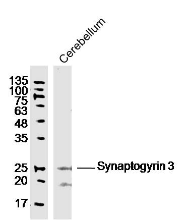 Mouse cerebellum lysates probed with Synaptogyrin 3 Polyclonal Antibody, Unconjugated (bs-11373R) at 1:300 dilution and 4˚C overnight incubation. Followed by conjugated secondary antibody incubation at 1:10000 for 60 min at 37˚C.