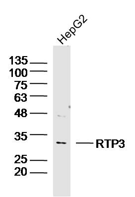 Human HepG2 lysates probed with RTP3 Polyclonal Antibody, Unconjugated (bs-11619R) at 1:300 dilution and 4˚C overnight incubation. Followed by conjugated secondary antibody incubation at 1:10000 for 60 min at 37˚C.