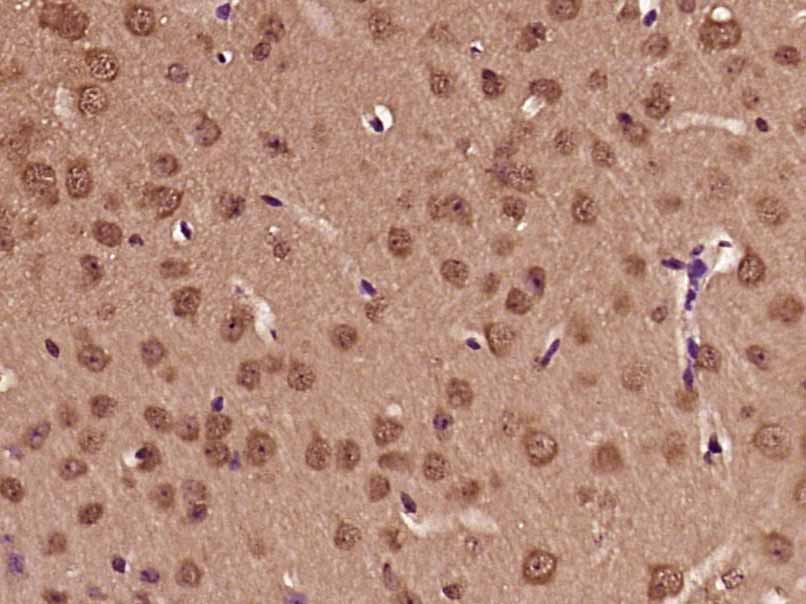 Paraformaldehyde-fixed, paraffin embedded Mouse brain; Antigen retrieval by boiling in sodium citrate buffer (pH6.0) for 15min; Block endogenous peroxidase by 3% hydrogen peroxide for 20 minutes; Blocking buffer (normal goat serum) at 37°C for 30min; Antibody incubation with PFDN3 Polyclonal Antibody, Unconjugated (bs-12628R) at 1:400 overnight at 4°C, DAB staining.