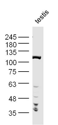 Mouse Testis lysates probed with PPP1R10 Polyclonal Antibody, Unconjugated (bs-11666R) at 1:300 dilution and 4˚C overnight incubation. Followed by conjugated secondary antibody incubation at 1:10000 for 60 min at 37˚C.