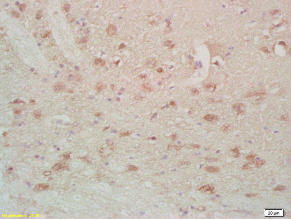 Formalin-fixed and paraffin embedded rat brain labeled with Anti-FABPB Polyclonal Antibody, Unconjugated (bs-2135R) at 1:200, followed by conjugation to the secondary antibody and DAB staining