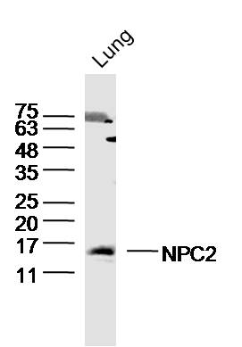 Mouse Lung lysates probed with NPC2 Polyclonal Antibody, Unconjugated (bs-11736R) at 1:300 dilution and 4˚C overnight incubation. Followed by conjugated secondary antibody incubation at 1:10000 for 60 min at 37˚C.