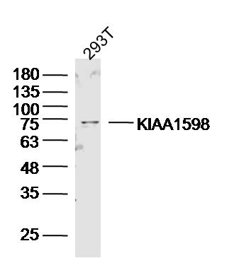 293T lysates probed with KIAA1598 Polyclonal Antibody, Unconjugated (bs-11863R) at 1:300 dilution and 4˚C overnight incubation. Followed by conjugated secondary antibody incubation at 1:10000 for 60 min at 37˚C.