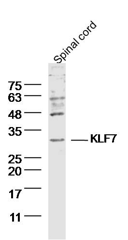 Mouse Spinal cord lysates probed with KLF7 Polyclonal Antibody, Unconjugated (bs-11865R) at 1:300 dilution and 4˚C overnight incubation. Followed by conjugated secondary antibody incubation at 1:10000 for 60 min at 37˚C.