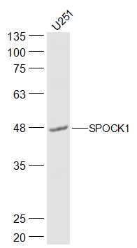 U251 lysates probed with SPOCK1 Polyclonal Antibody, Unconjugated (bs-11965R) at 1:500 dilution and 4˚C overnight incubation. Followed by conjugated secondary antibody incubation at 1:10000 for 60 min at 37˚C.