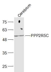 Mouse cerebrum lysates probed with PPP2R5C Polyclonal Antibody, Unconjugated (bs-11991R) at 1:300 dilution and 4˚C overnight incubation. Followed by conjugated secondary antibody incubation at 1:10000 for 60 min at 37˚C.