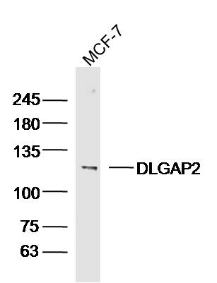 MCF-7 lysates probed with DLGAP2 Polyclonal Antibody, Unconjugated (bs-12139R) at 1:300 dilution and 4˚C overnight incubation. Followed by conjugated secondary antibody incubation at 1:10000 for 60 min at 37˚C.