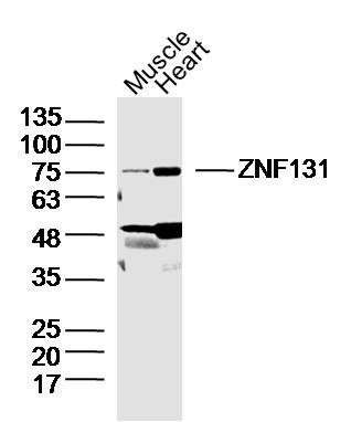 Lane 1: Mouse Muscle lysates; Lane 2: Mouse Heart lysates probed with ZNF131 Polyclonal Antibody, Unconjugated (bs-12233R) at 1:300 dilution and 4˚C overnight incubation. Followed by conjugated secondary antibody incubation at 1:10000 for 60 min at 37˚C.
