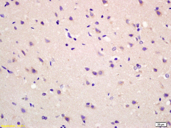 Formalin-fixed and paraffin embedded rat brain labeled with Anti-MAS1L Polyclonal Antibody, Unconjugated (bs-5926R) at 1:200 followed by conjugation to the secondary antibody and DAB staining.