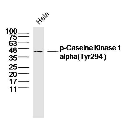 Hela lysates probed with Casein Kinase 1 alpha (Tyr294) Antibody, Unconjugated (bs-12428R) at 1:300 dilution and 4˚C overnight incubation. Followed by conjugated secondary antibody incubation at 1:10000 for 60 min at 37˚C.
