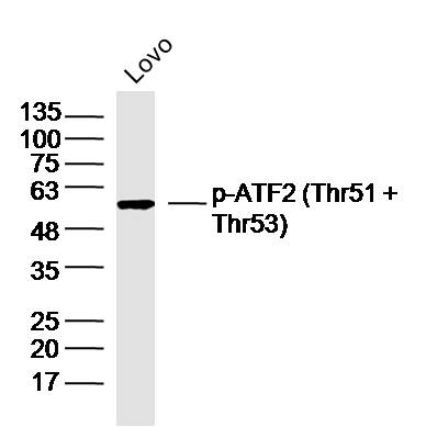 LOVO lysates probed with p-ATF2 (Thr51 + Thr53) Polyclonal Antibody, Unconjugated (bs-12537R) at 1:300 dilution and 4˚C overnight incubation. Followed by conjugated secondary antibody incubation at 1:10000 for 60 min at 37˚C.