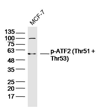 MCF-7 lysates probed with p-ATF2 (Thr51 + Thr53) Polyclonal Antibody, Unconjugated (bs-12537R) at 1:300 dilution and 4˚C overnight incubation. Followed by conjugated secondary antibody incubation at 1:10000 for 60 min at 37˚C.