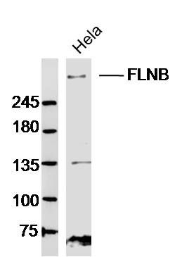 Hela lysates probed with FLNB Polyclonal Antibody, Unconjugated (bs-13181R) at 1:300 dilution and 4˚C overnight incubation. Followed by conjugated secondary antibody incubation at 1:10000 for 60 min at 37˚C.