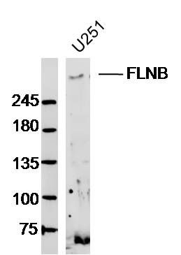 U251 lysates probed with FLNB Polyclonal Antibody, Unconjugated (bs-13181R) at 1:300 dilution and 4˚C overnight incubation. Followed by conjugated secondary antibody incubation at 1:10000 for 60 min at 37˚C.