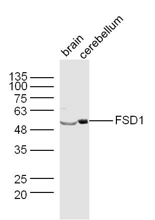 Lane 1: Mouse Brain lysates; Lane 2: Mouse Cerebellum lysates probed with FSD1 Polyclonal Antibody, Unconjugated (bs-13220R) at 1:300 dilution and 4˚C overnight incubation. Followed by conjugated secondary antibody incubation at 1:10000 for 60 min at 37˚C.