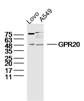 Lane 1: LOVO lysates; Lane 2: A549 lysates probed with GPR20 Polyclonal Antibody, Unconjugated (bs-13523R) at 1:300 dilution and 4˚C overnight incubation. Followed by conjugated secondary antibody incubation at 1:10000 for 60 min at 37˚C.
