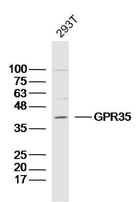 293T lysates probed with GPR35 Polyclonal Antibody, Unconjugated (bs-13533R) at 1:300 dilution and 4˚C overnight incubation. Followed by conjugated secondary antibody incubation at 1:10000 for 60 min at 37˚C.