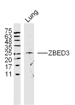 Rat lung lysates probed with ZBED3 Polyclonal Antibody, Unconjugated (bs-13553R) at 1:300 dilution and 4˚C overnight incubation. Followed by conjugated secondary antibody incubation at 1:10000 for 60 min at 37˚C.