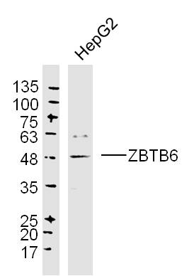 HepG2 lysates probed with ZBTB6 Polyclonal Antibody, Unconjugated (bs-13582R) at 1:300 dilution and 4˚C overnight incubation. Followed by conjugated secondary antibody incubation at 1:10000 for 60 min at 37˚C.