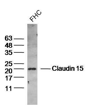 Human FHC lysates probed with Claudin 15 Polyclonal Antibody, Unconjugated (bs-13753R) at 1:300 dilution and 4˚C overnight incubation. Followed by conjugated secondary antibody incubation at 1:10000 for 60 min at 37˚C. Human FHC lysates probed with Claudin 15 Polyclonal Antibody, Unconjugated (bs-13753R) at 1:300 dilution and 4˚C overnight incubation. Followed by conjugated secondary antibody incubation at 1:10000 for 60 min at 37˚C.