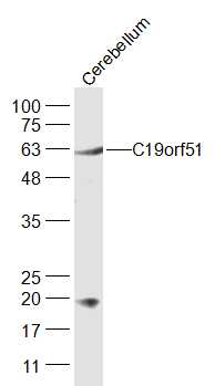 Mouse cerebellum lysates probed with C19orf51 Polyclonal Antibody, Unconjugated (bs-13787R) at 1:300 dilution and 4˚C overnight incubation. Followed by conjugated secondary antibody incubation at 1:10000 for 60 min at 37˚C.